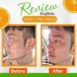 เซรั่มขุนพลนางพญา ผิวใส เซรั่มลดฝ้า กระ ผิวกระชับ เซรั่มนางพญา ขุนพล เซรั่มหัวไชเท้า  วิตามินซี 1 ขวด 15 ml. พร้อมส่ง !!