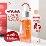 Merdragon, white acne serum, pores, tightening dark spots, 1 free, 2 dragon serum, Mard Ring, nourishing the skin, dragon blood extract, soap / serum / cream