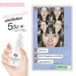Clear white skin serum 1 Free 1 Free Toner Collagen Omijar Serum by Pichlook Serum Om Jar from Korea, reduce acne, freckles.