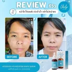 Cherlyn Intensive Hya Booster White Serum serum, 1 bottle of acne, freckles, 30ml. Free delivery.