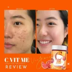 C VIT ME วิตซี วิตามินเสริมภูมิคุ้มกัน 1 ช้อน = ส้ม99ลูก วิตามินซี รสน้ำส้มแฟนต้า ซีวิต มี 1 กระปุก 200,000mg. พร้อมส่ง