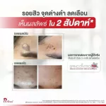 Puricas Scar Gel /Plus C&E Scar Gel Pure Rickaes Lower Loles