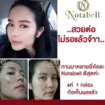 อาหารเสริมบำรุงผิว Notabell โนตาเบล