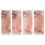 KIEHL'S - Clearly Corrective Dark Spot Solution 4ml