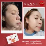 3 กล่อง Sanae - Collagen Plus ซเน่คอลลาเจนพลัส อาหารเสริมผิวขาวใส ไร้สิว