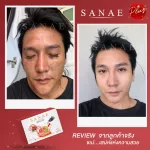 15 แถม 2 กล่อง Sanae - Collagen Plus ซเน่คอลลาเจนพลัส อาหารเสริมผิวขาวใส ไร้สิว