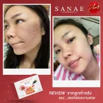 3 กล่อง Sanae - Collagen Plus ซเน่คอลลาเจนพลัส อาหารเสริมผิวขาวใส ไร้สิว