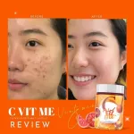 1 jar 200 grams C Vit Me New Civeit has 200,000mg.