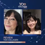 2 Get 4 Free Delivery YOO Collagen Clear skin Nourishing Eukol Collagen Pure Collagen Pure collagen, knees, bones, skin, free delivery