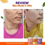 Vitamin C against colds, enhance the landscape 2, get 1 acne, white skin, vitamin C, good vitamin C, dazzling deproud bio multi c Mix, vitamin C 3 flavors