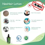 Neo Hair Lotion Neohair 2 bottles