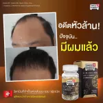 Free SWISS Energy HN & S Hair Nail Skin, hair care, nails, hair loss, thin, gray, stimulating new hair