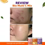 วิตามินซีสด 4 แถม 4 ดีพราวด์ Deproud Bio Vitaminc ดีพราว วิตามิน ผิวขาวใส วิตซีถัง ลดสิว คอลลาเจน กลูต้า ต้านหวัดภูมิแพ้ ส่งฟรี