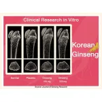 Lekcapp Gold เลคแคปป์ โกล สมุนไพรบำรุงสุขภาพกระดูกทั่วร่างกาย และข้อเข่า คิดค้นโดยหมอแบงค์ นพ และ ผู้เชี่ยวชาญด้านสมุนไพรกว่า 10 ปี