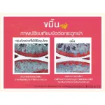 Lekcapp Gold เลคแคปป์ โกล สมุนไพรบำรุงสุขภาพกระดูกทั่วร่างกาย และข้อเข่า คิดค้นโดยหมอแบงค์ นพ และ ผู้เชี่ยวชาญด้านสมุนไพรกว่า 10 ปี