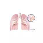 Lung supplements and bronchial cleaning For people who are heavy, there are phlegm from smoking, inhaling, dust or colds.