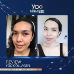 Yoo Collagen is directly sent from the company !!! White collagen nourishes bones 110 grams. Collagen Boy Pisanu has no smell, no sugar, vitamins, free gifts, yoo face mask.