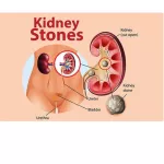 รวมสมุนไพร 7 ชนิด Kidney Cleanse 90 Veggie Caps Now Foods®