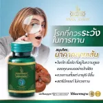 นาคาคลายเส้น ปวดเมื่อย ปวดหลัง ปวดเข่า ปวดกล้ามเนื้อ เส้นตึง เอ็นยึด Naka Kyzen 1 กระปุก 30 แคปซูล พร้อมส่ง