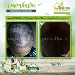 Herbal Doctor House, Skin Skin Spa, Moisture Spa Oil, dry skin, psoriasis rash, size 120/500 ml.