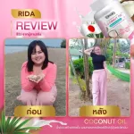 Rida Coconut Oil ริด้า น้ำมันมะพร้าวสกัดเย็นผสมคอลลาเจนและวิตามิน MCT Oil สูง ลดน้ำหนัก ควบคุมน้ำหนัก บำรุงสุขภาพ