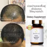 Dietary Supplement Product วิตามินบำรุงผม วิตามินบำรุงผมร่วง ลดผมร่วงอาหารเสริมและผลิตภัณฑ์สุขภาพHair Supplement