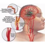 ทับทิมชนิดเม็ด กิฟฟารีน กรานาดา บำรุงเลือด หัวใจ ตับ granada giffarine