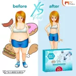 MVMALL XS Plus Health & Fit XS Plus Health Program 30 days 15 capsule weight loss supplements