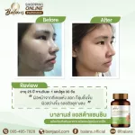 Balance Asta Sandin Plus