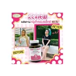 SUPURRA กลูต้าคอมเพล็กซ์..ตราสุเพอร์ร่า