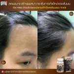 SWISS ENERGY HN & S 1 box. Free water. HAIR NAIL SKIN 30 Capsules Care Lake Nail hair, hair loss, hair loss stimulates the new hair.