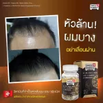 Swiss Energy HN & S 4 large boxes, 1 small box +glasses, Hair Nail Skin 30 capsules, hair care, nails, hair loss, up hair loss, stimulating new hair