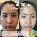 White skin vitamins, easy to sleep, 2 free 1, free delivery ++ Merry Daily x Dr.Mas, vitamin Chong, drinking white Increase the quality of sleep, reduce stress, 2 flavors, ready to deliver !!!