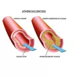 สารสกัดจากเห็ดปุยฝ้าย Lion's Mane Full Spectrum Organic Certified 90 Veggie Capsules California Gold Nutrition®