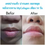 My Collagen Plus Synbiotic My Collagen Plus-New Mycollagen Plus Collagen Vitamin Fruit Vegetables in 1 box contains 10 sachets.