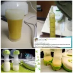 Full value, special care package, with automatic pump, Calypso-TO-TO-TO-TO-TO Pump and Luggage set