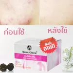 เซนต์ แคลร์ ครีมทาสิว saint claire ขนาด 7 มิลลิกรัม