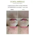 พร้อมส่ง  เซรั่มลดสิว BE PLAIN Cicaful Ampoule 30ml รักษาสิว ดูแลสิว Acne Aid