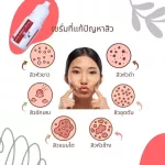 เซตดูแลผิวเป็นสิว เจลนวดหน้า เกรดคลินิค วิตามินบีสาม+เซรั่มลดสิว+เซรั่มรักษาขนคุด สิวที่หลัง แถมฟรี! เครื่องผลักวิตามิน