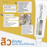 Welpano Acne Gel เจลแต้มสิว