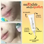 Welpano Acne Gel 2 หลอด