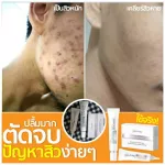 Welpano Acne Gel 2 หลอด
