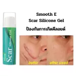 SMOOTH E SCAR SILICONE GEL + SCAR ROLLER - สมูทอีสการ์ซิลิโคนเจล พร้อมสการ์โรลเลอร์