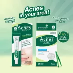 Mentholatum Acnes Sealing Jell Acne Treatment Gel 18g. (2แพค) เมนโทลาทั่ม แอคเน่ ซิลลิ่ง เจล แอคเน่ ทรีทเมนท์ เจล