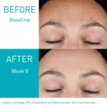 (พร้อมส่ง/ของแท้/มีใบนำเข้า)แพ็คเกจอเมริก,Cerave Resurfacing Retinol Serum 30ml