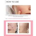 Cathy Doll แอนตี้แอคเน่เคลียร์เจลทูเปอร์เซ็นต์ซาลิไซลิกแอซิด 15g เจลแต้มสิวสูตรเร่งด่วน