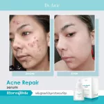 Dr.Awie Acne Repair Serum เซรั่มลดสิว 5 ขวด 100 ml เซรั่มเนื้อบางเบา ซึมไว ไม่เหนียว ผิวใส ลดสิว สิวอุดตัน ความมัน ลบรอยสิว ด่างดำ ออเกนิค เด็กใช้ได้