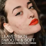 นูโทรจีนา เจลล้างหน้า สำหรับผิวเป็นสิว Fragrance-Free Stubborn Texture Daily Cleanser 186 ml (Neutrogena®)