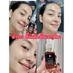 Golden ginseng serum, white skin, clear skin, reduce acne, reduce freckles * Authentic-new* Korean ginseng root, hydrops, sensitive skin, freckles, serum, golden ginseng, Korean serum 30ml.