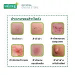 Smooth E Anti Body Acne Spray 50ml. - สเปรย์ลดสิวที่ผิวหลัง และผิวกาย ช่วยดูแลปัญหาสิว ลดสิวอุดตัน ลดปัญหาสิวโดยไม่ทิ้งรอยดำ ป้องกันการเกิดใหม่ของสิว